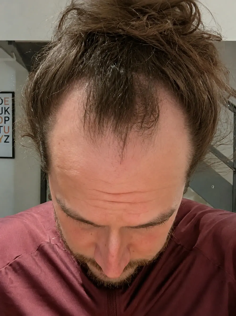 Adam Pereira before