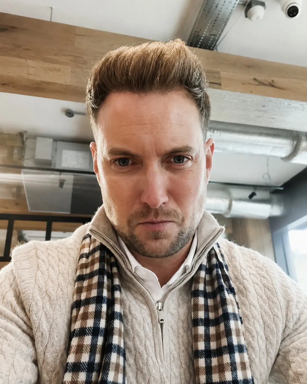 Steve's HairTransplant Review after