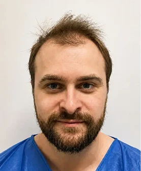 Harry Woods' Transplant Review before