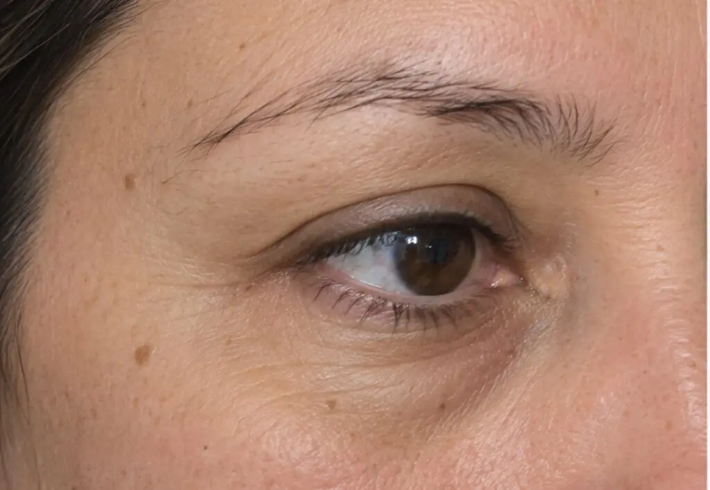 Eyebrows before