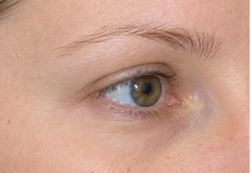 Eyebrows before